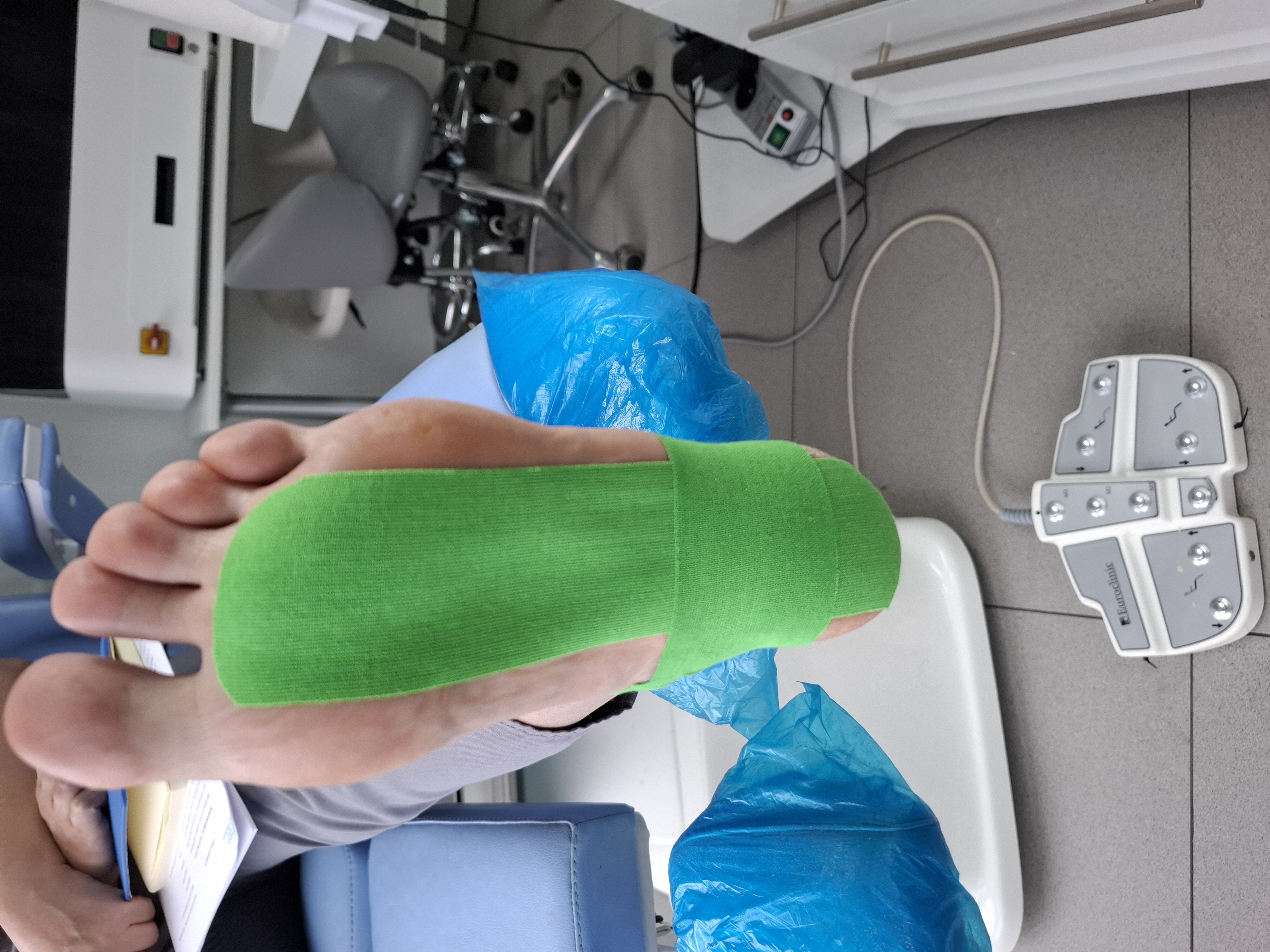 zdjęcie obrazuje w prybliżeniu taping na ostrodze piętowej